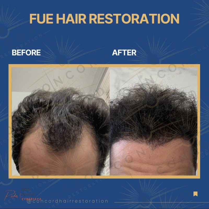 TOP 10 BEST Hair Loss Dermatologist in Los Angeles, CA - Updated 2026 - Quality & Affordability - Yelp TOP 10 BEST Hair Loss Dermatologist in Los Angeles, CA - Updated 2026 - Quality & Affordability - Yelp