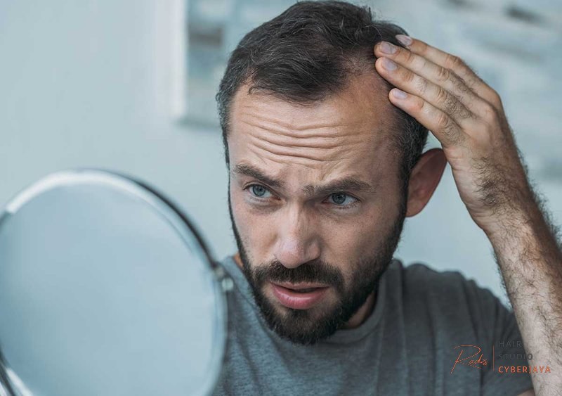 Top Hair Loss Specialist Near Me in Birmingham, AL | Ginsburg Dermatology Hair Loss Specialist Near Me in Birmingham, AL | Ginsburg Dermatology