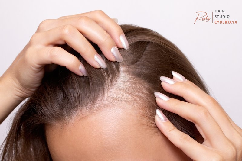 Hair Loss Treatment Dallas | Hair Loss Dermatologist Dallas Hair Loss Treatment Dallas | Hair Loss Dermatologist Dallas