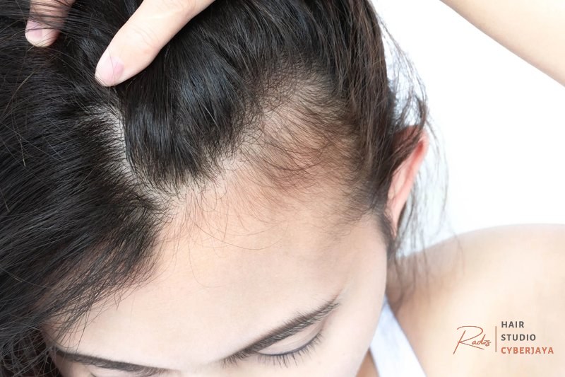 Does Vaping Cause Hair Loss Nioxin GB Does Vaping Cause Hair Loss? | Nioxin GB