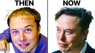 Surgeon Reacts to Elon Musk's Hair Transplant Elon Musk's Hair Transplant | Surgeon Reacts