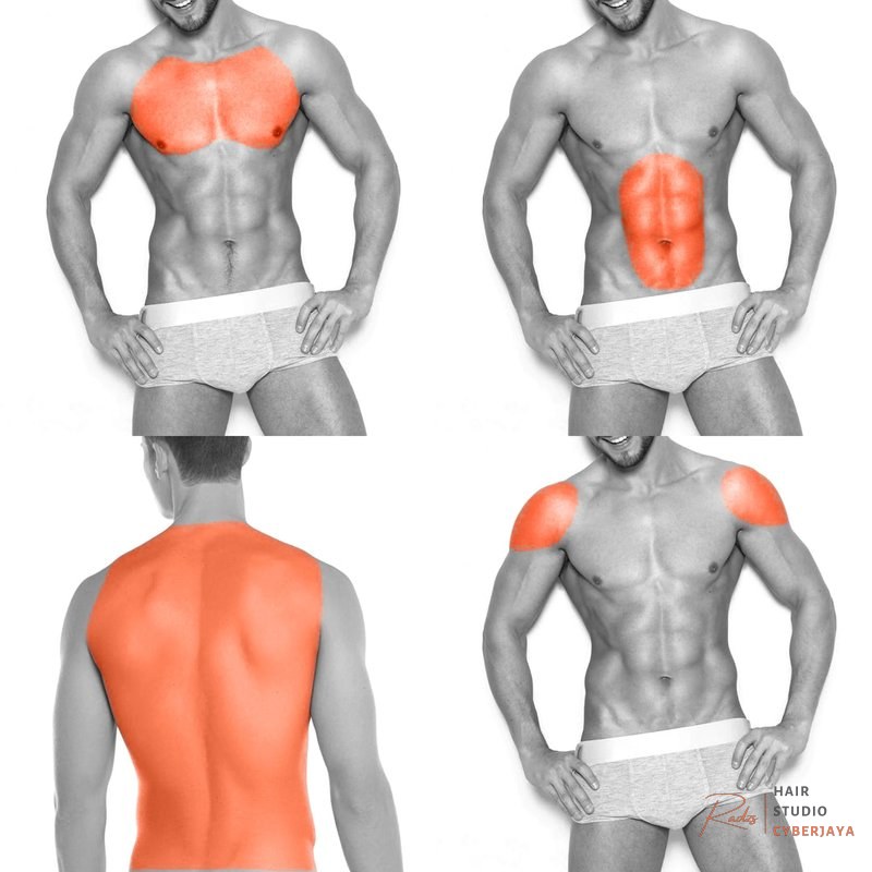 Comprehensive men's laser hair removal Full Chest, Stomach, Back & Shoulders Laser Hair Removal for Men (6 Se – Infinity Laser Spa