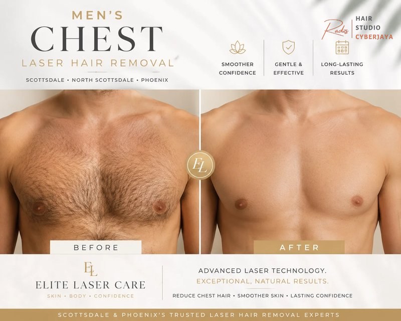 Laser hair removal chest before and after Men's Chest Laser Hair Removal Scottsdale & North Phoenix | Elite Laser Care