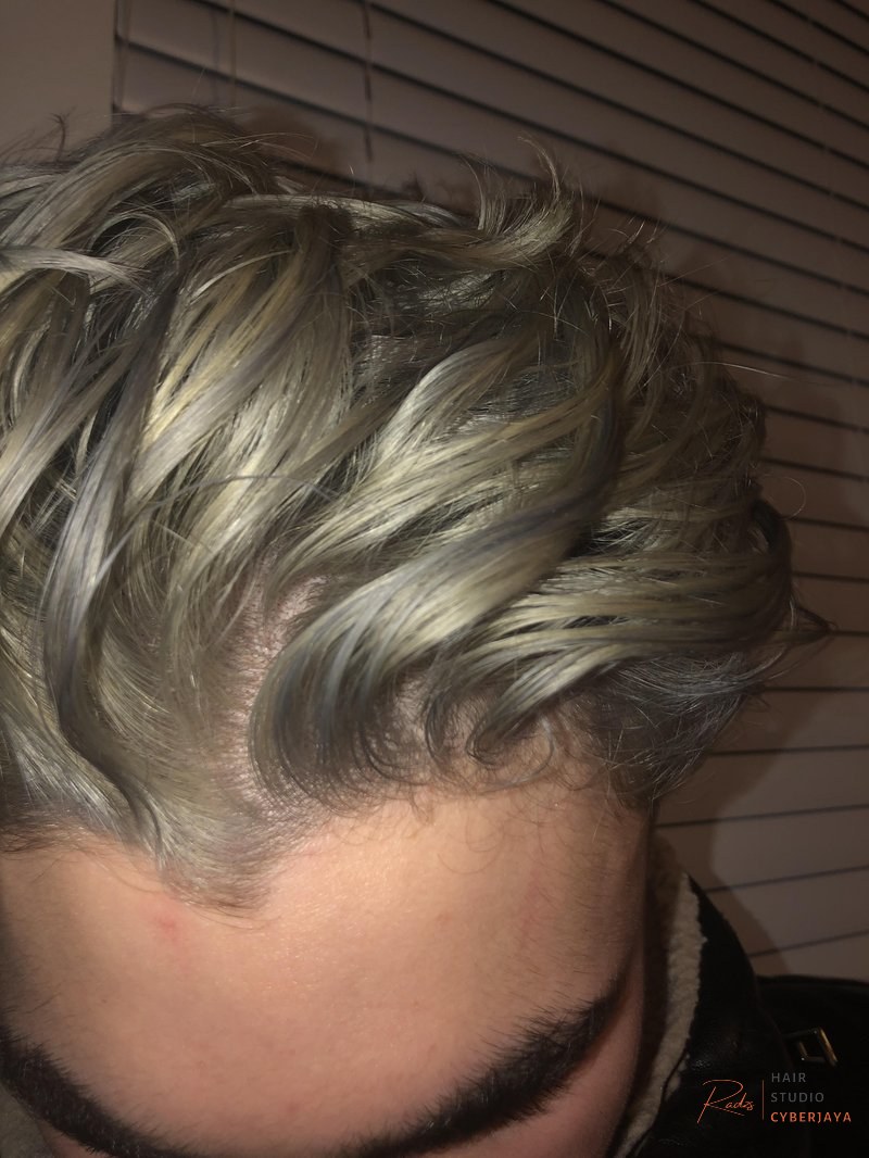 HELP! How do i fix my uneven silver hair dye? Should i bleach bath the whole thing? or just the yellowed not so silver sections. what should i do?! : r/Hair HELP! How do i fix my uneven silver hair dye? Should i bleach bath the whole thing? or just the yellowed not so silver sections. what should i do?! : r/Hair