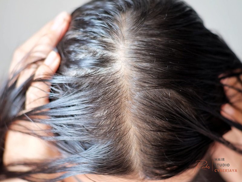 PCOS and Hair Loss: Why It Happens and How to Treat It - Business Insider PCOS and Hair Loss: Why It Happens and How to Treat It - Business Insider