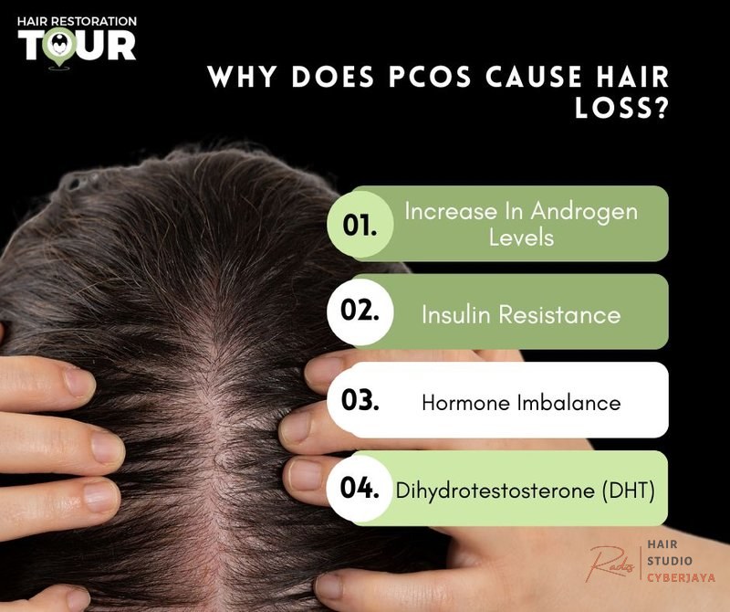 PCOS Hair Loss | Causes, Treatments And Recovery PCOS Hair Loss | Causes, Treatments And Recovery